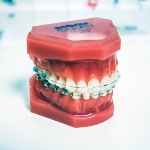 17-關於牙齒～牙齒矯正