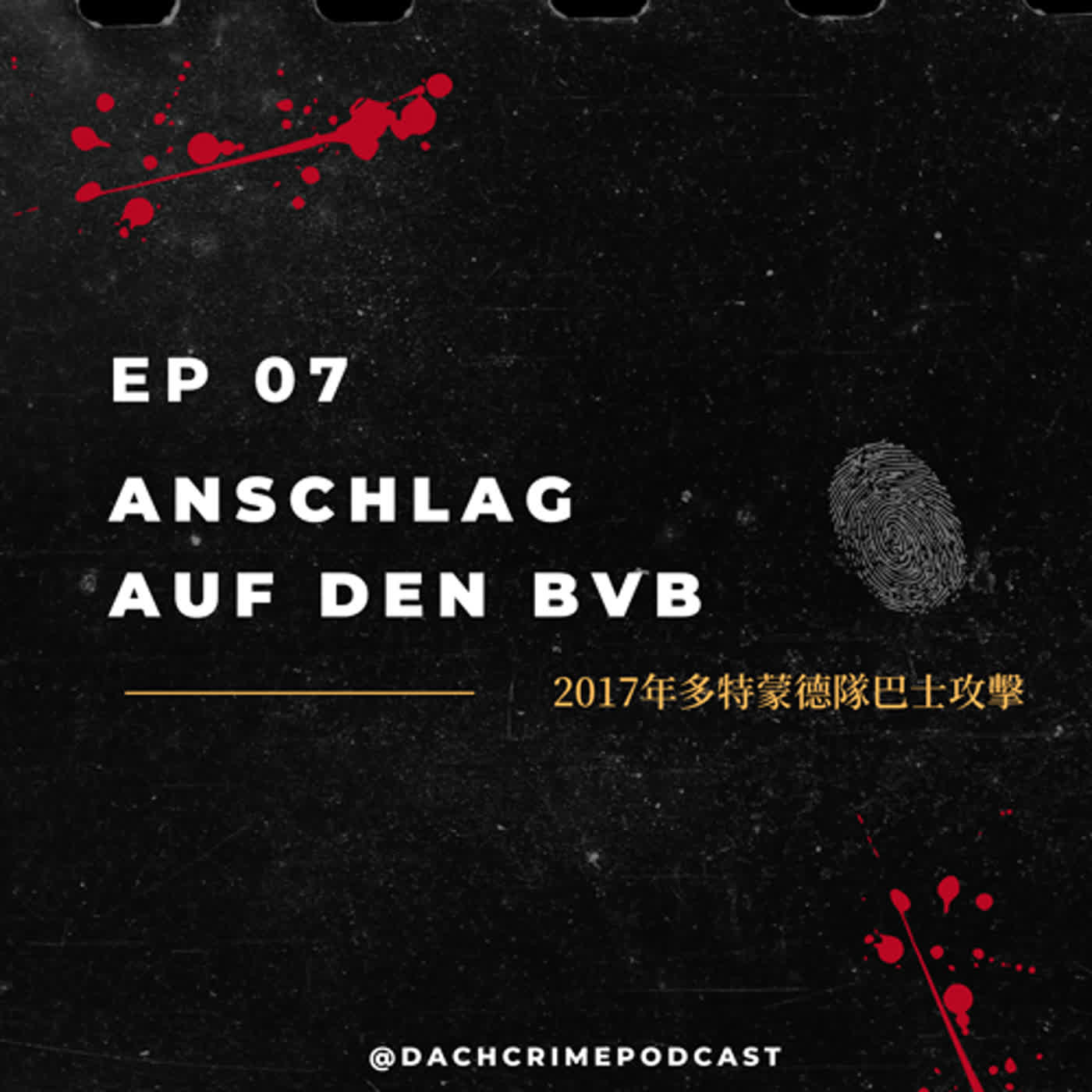 S5 EP7. 2017年多特蒙德隊巴士攻擊｜Anschlag auf den BVB