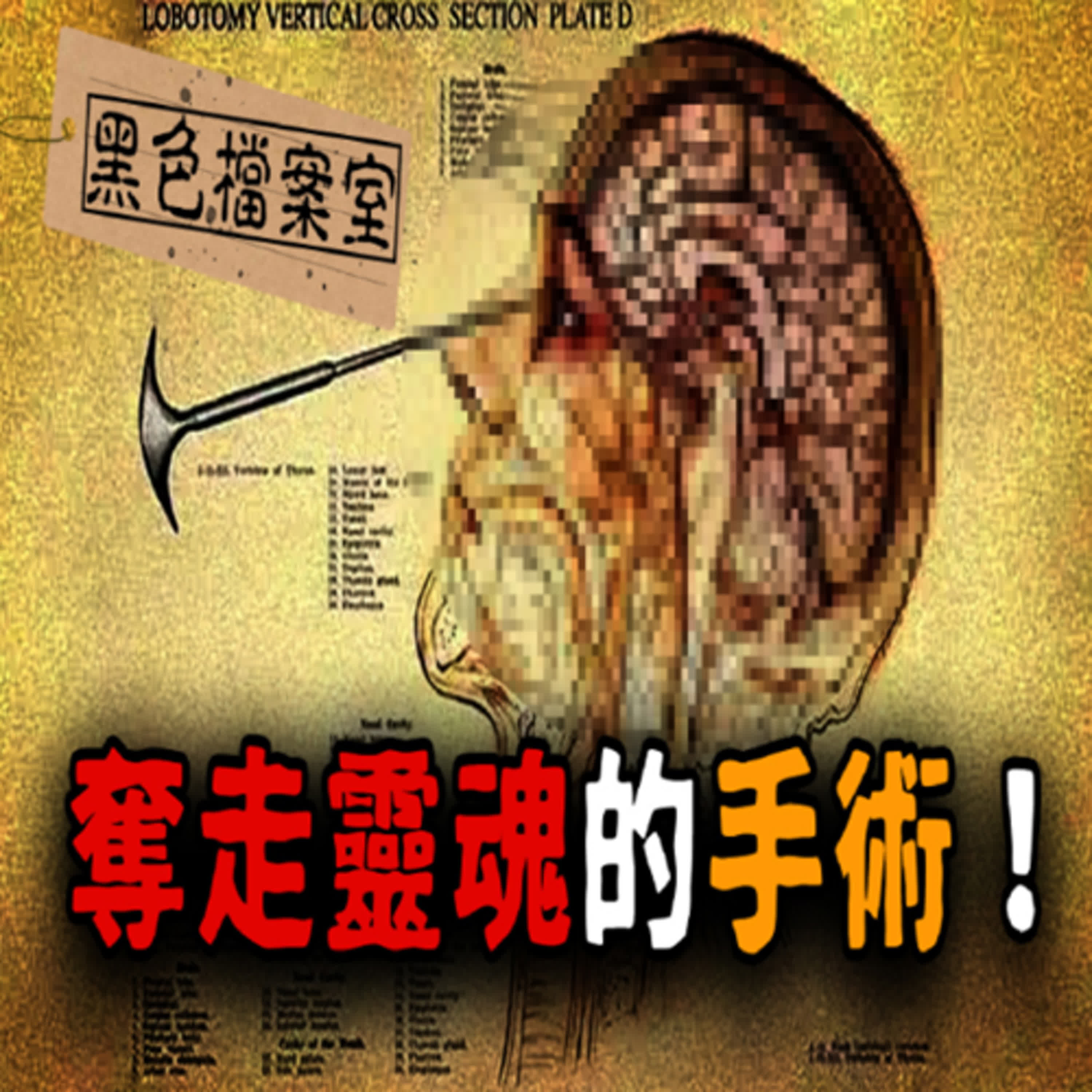 「一個瘋子變成了白痴...」施行這道手術的人餘生全毀！靈魂剝離手術｜下水道先生 episode artwork