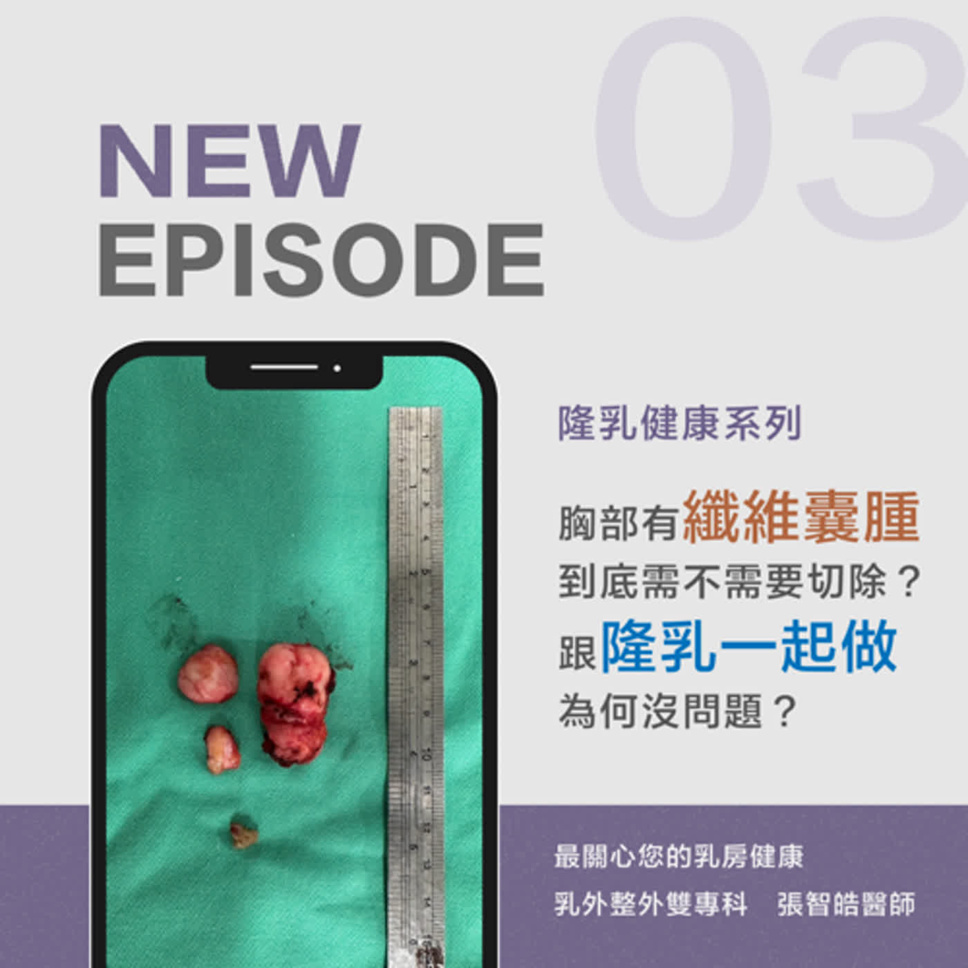 EP3. 胸部有纖維囊腫到底需不需要切除？跟隆乳一起做為何沒問題？