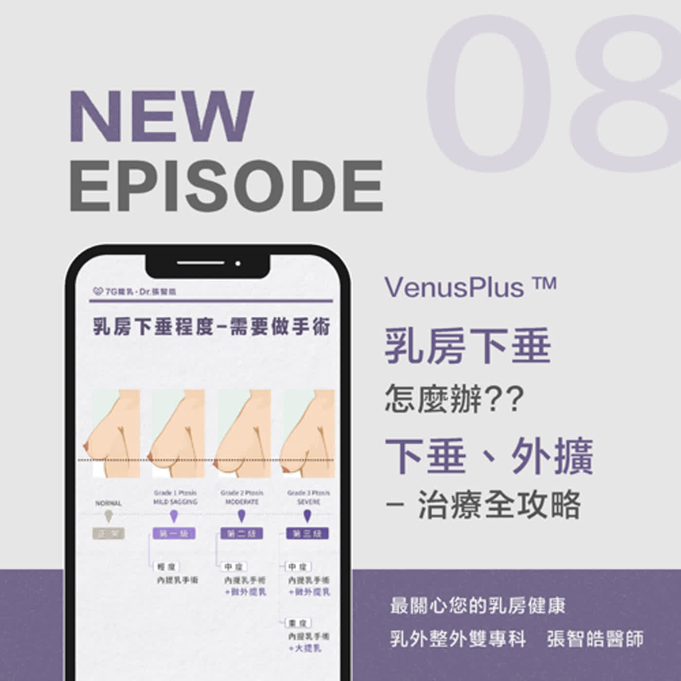 【張智皓醫師PODCAST】關心您的乳房大小事#8∣胸部下垂怎麼辦，垂乳治療全攻略‼️