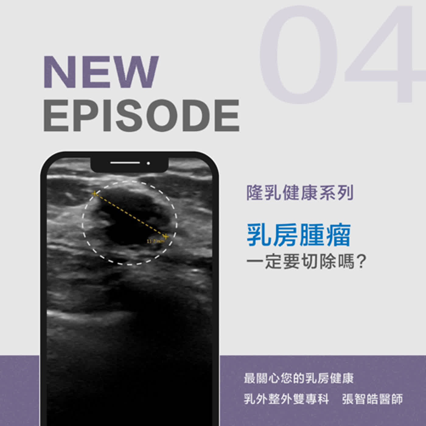 EP4. 乳房腫瘤一定要切除嗎?