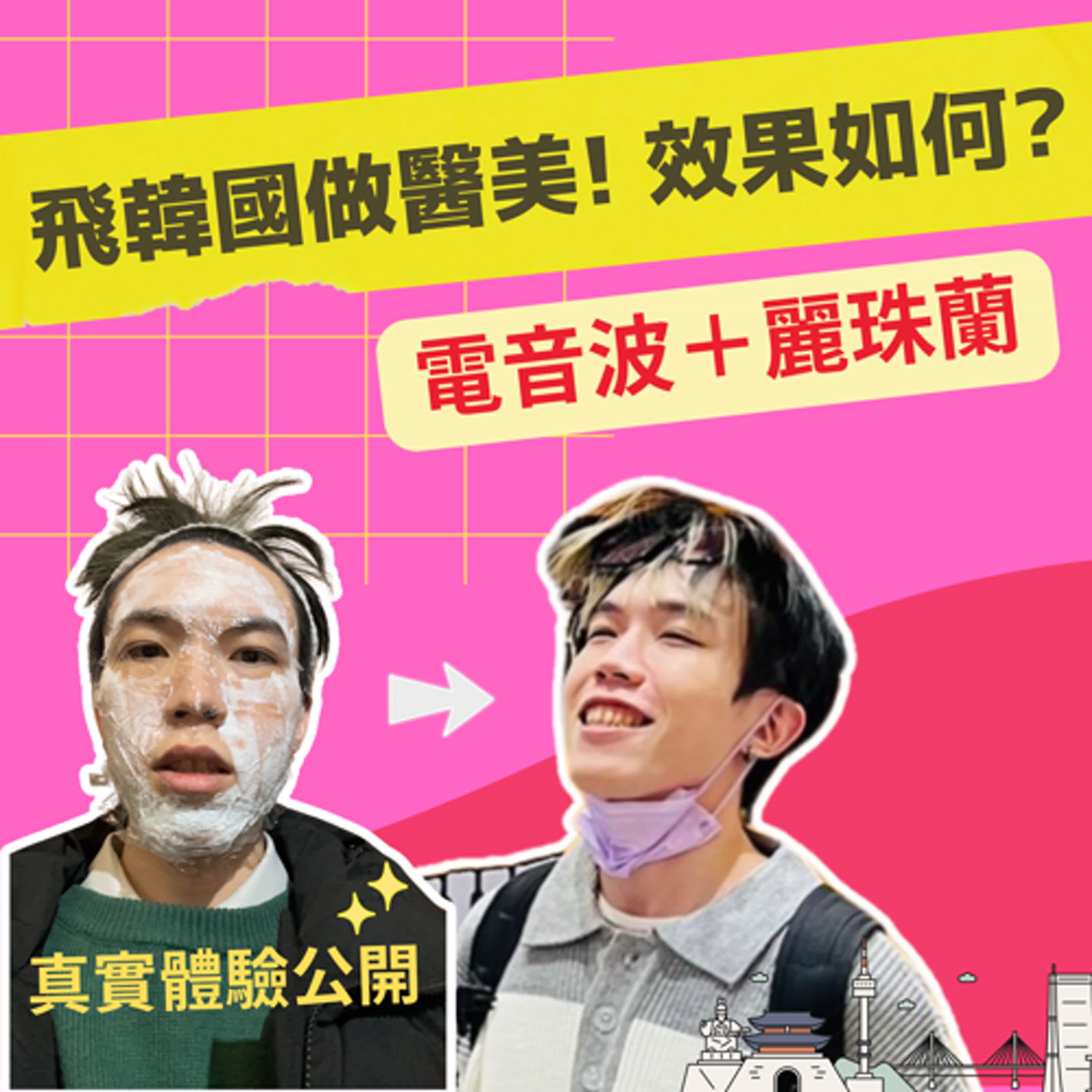 【韓國醫美體驗】電音波、麗珠蘭、肉毒除皺，實測效果大公開！