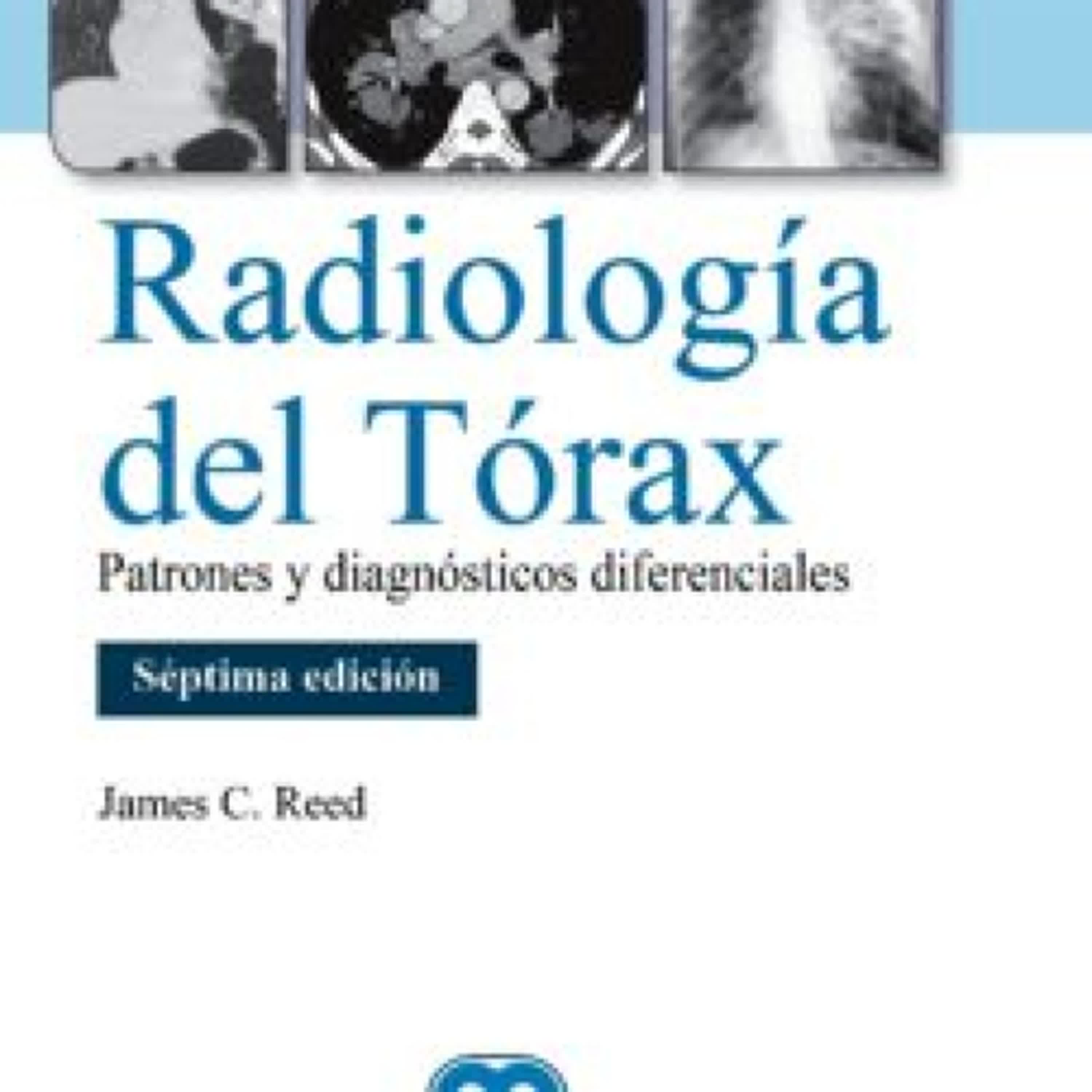 {pdf descargar} RADIOLOGÍA DEL TÓRAX. PATRONES Y DIAGNÓSTICOS DIFERENCIALES (7ª ED.)