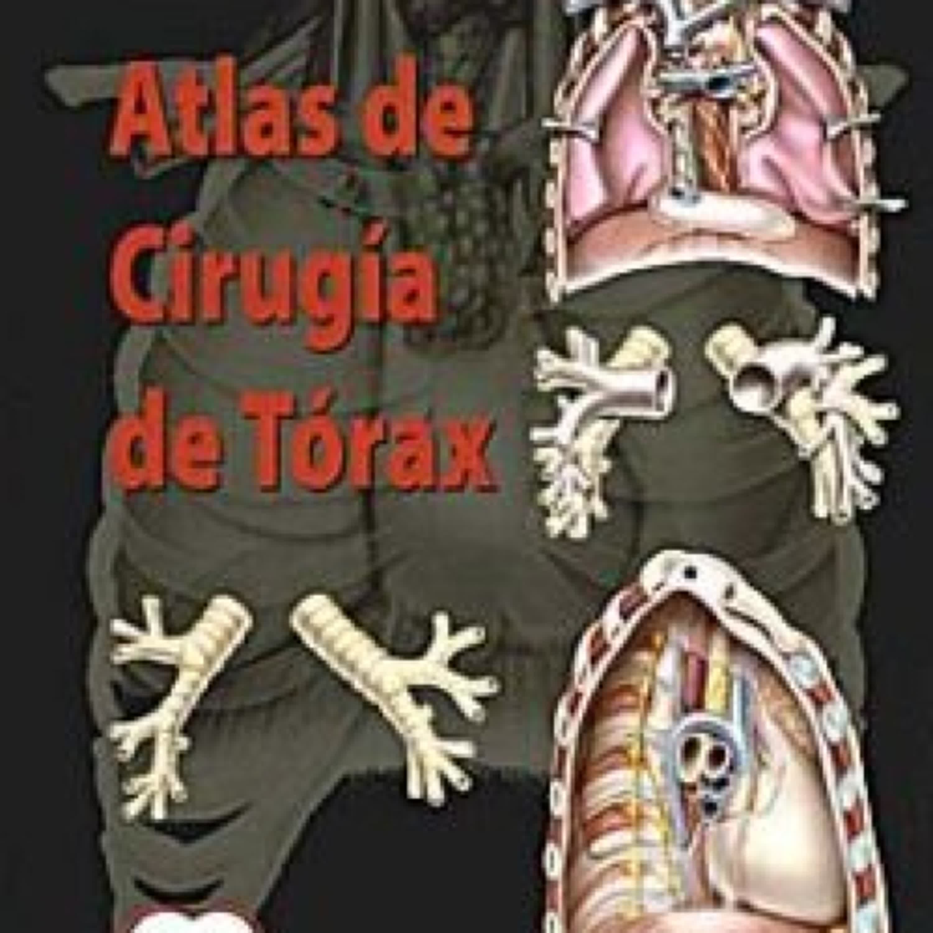 ATLAS DE CIRUGIA DE TORAX leer epub gratis