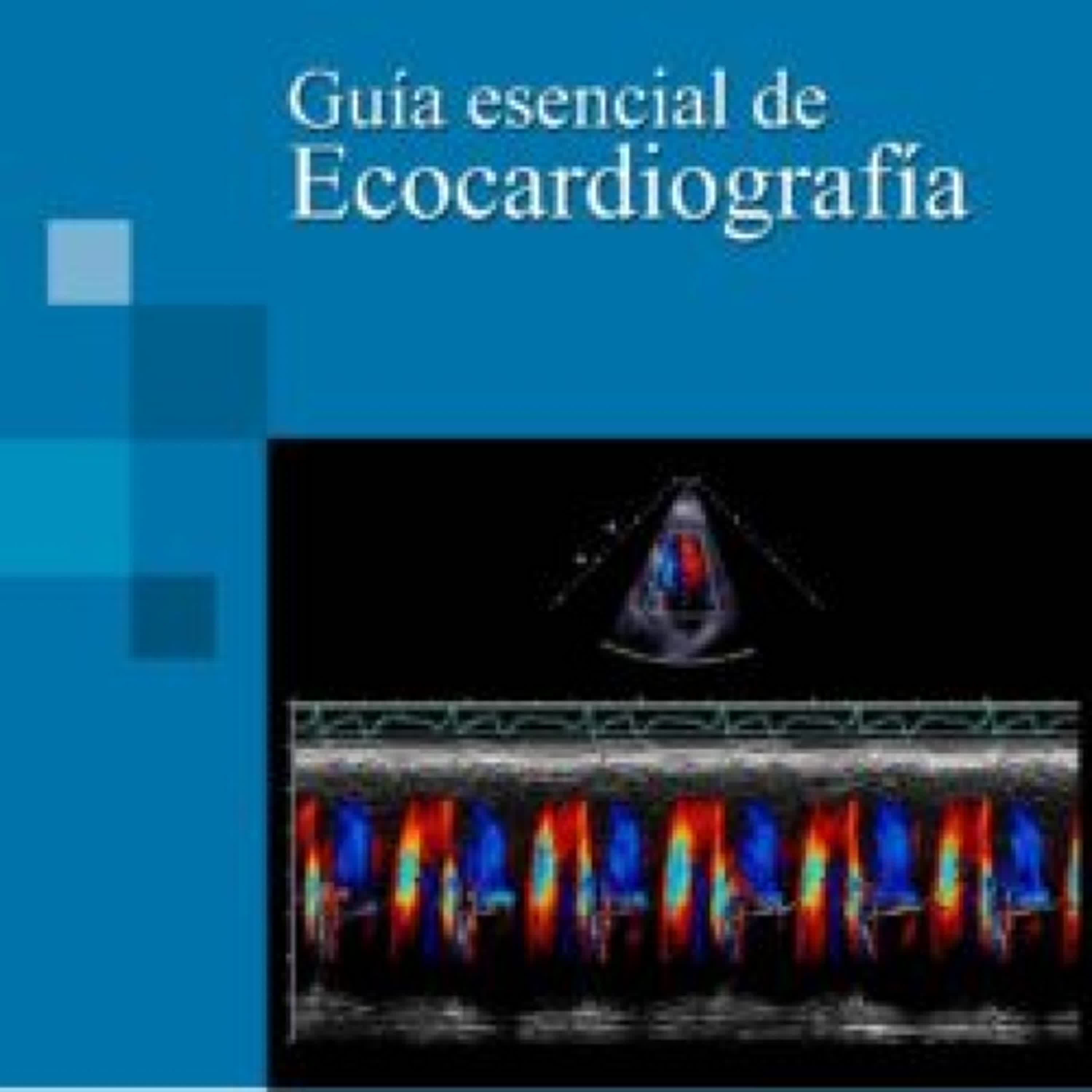GUIA ESENCIAL DE ECOCARDIOGRAFIA leer epub gratis