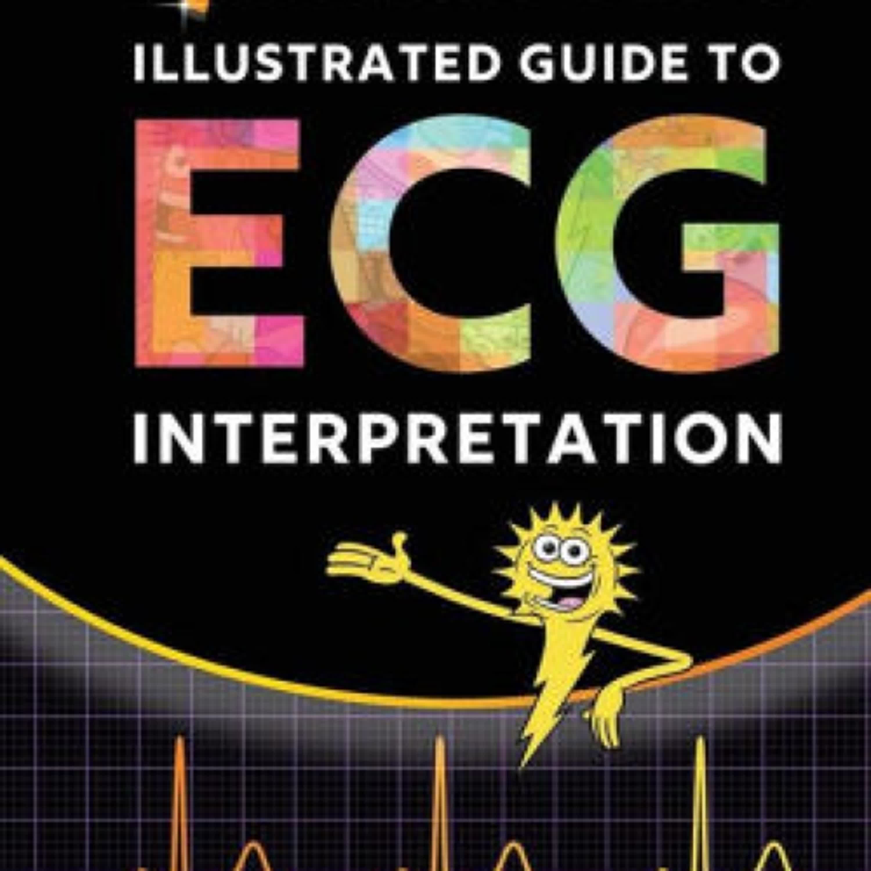 Download Pdf Sparkson's Illustrated Guide to ECG Interpretation by Jorge Muniz