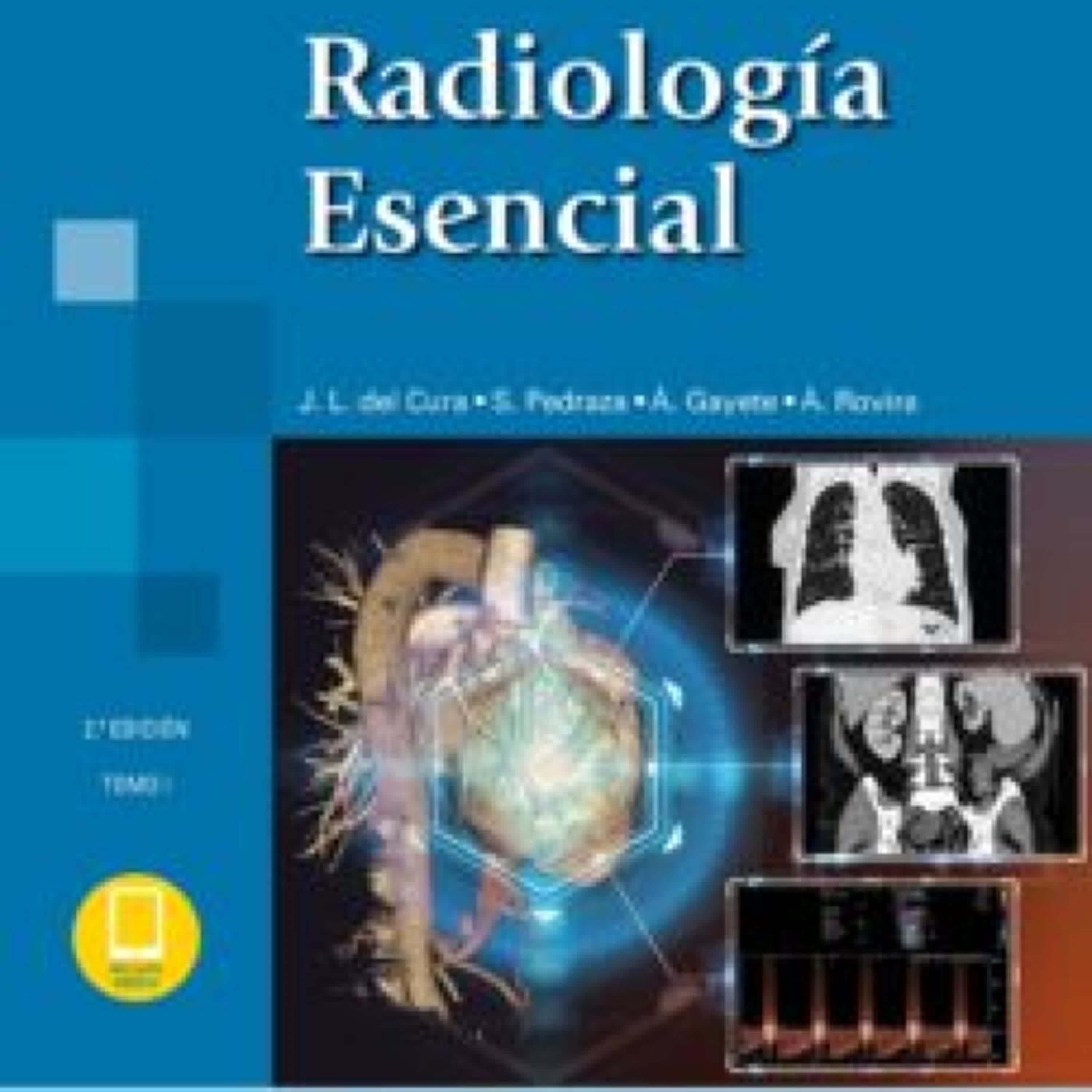 [Pdf/ePub/Mobi] RADIOLOGÍA ESENCIAL 2 VOLUMENES (2ª ED.) - SERAM descargar ebook gratis