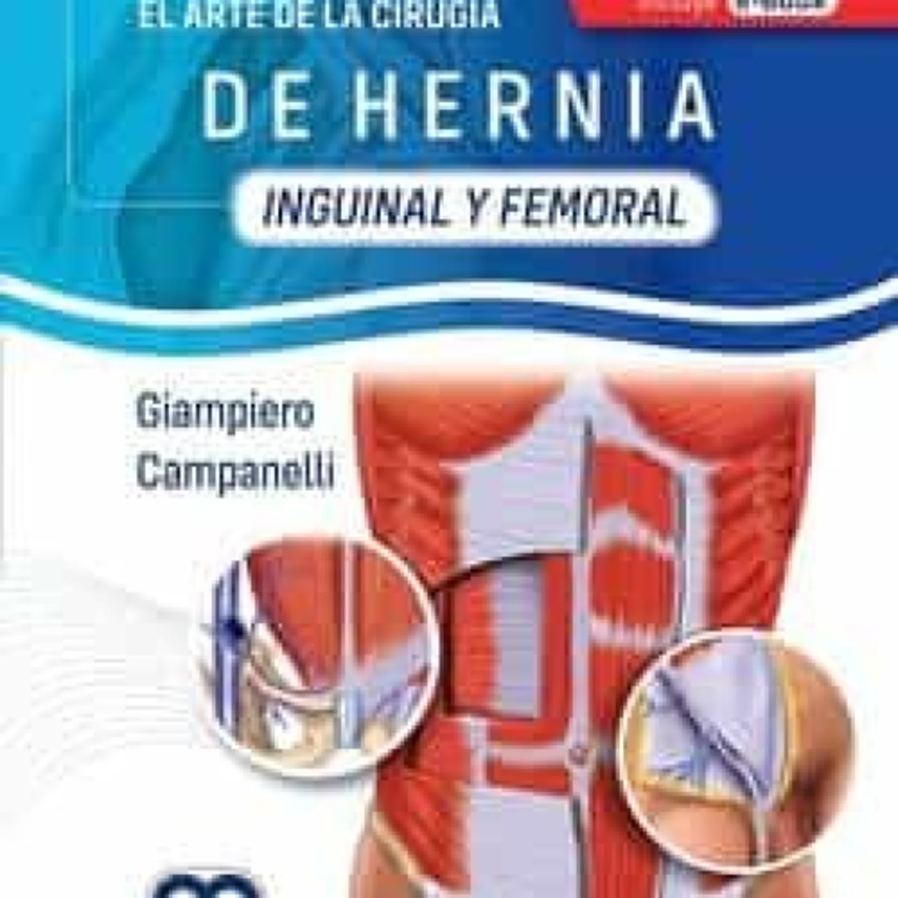 EL ARTE DE LA CIRUGÍA DE HERNIA. INGUINAL Y FEMORAL leer el libro pdf