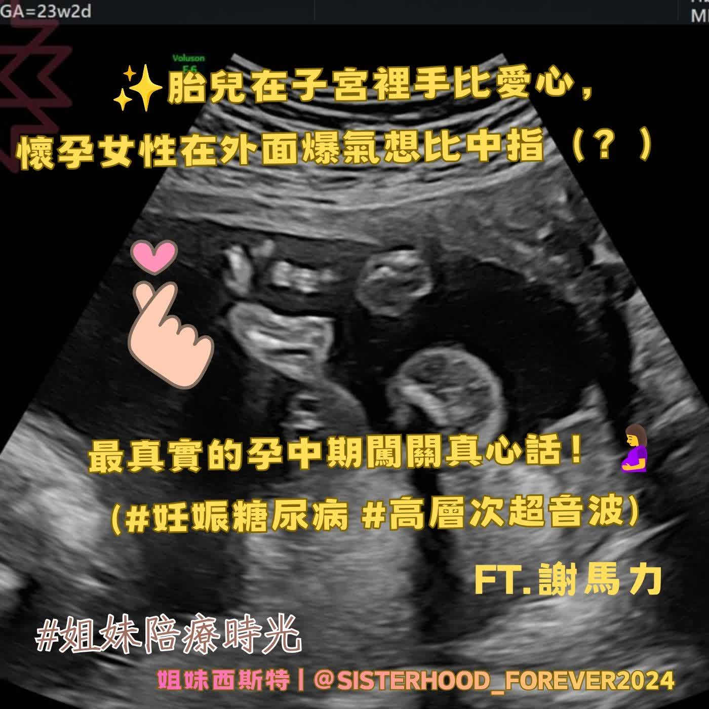 ✨【胎兒在子宮裡手比愛心，懷孕女性在外面爆氣想比中指（？）—最真實的孕中期闖 關真心話！】 episode artwork