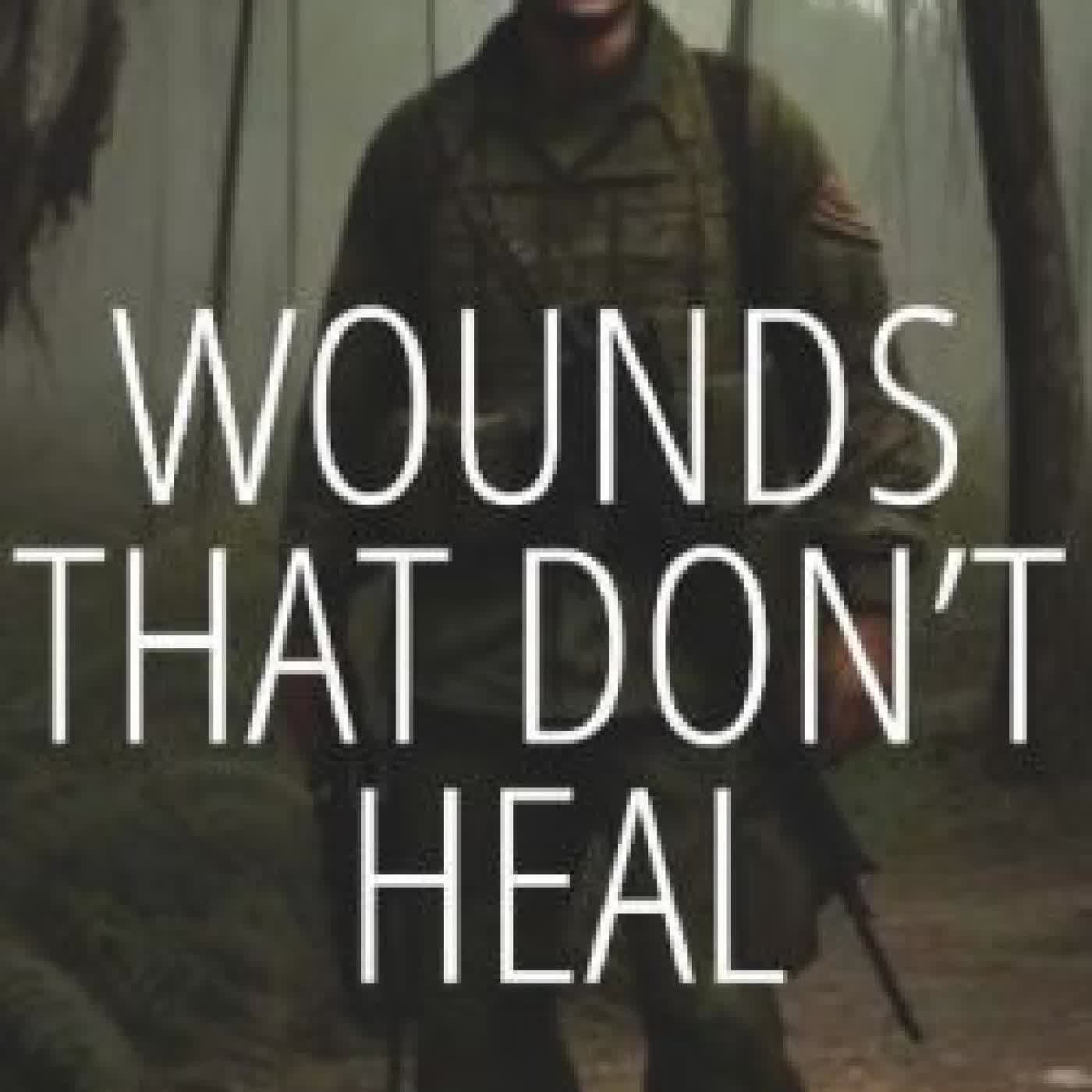 Read online: Wounds That Don't Heal by Emmett Breech