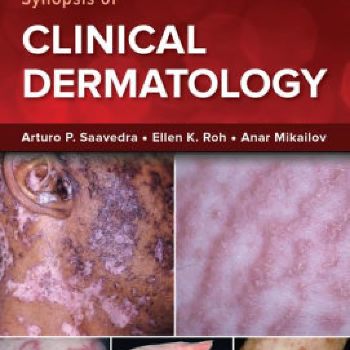 Fitzpatrick's Color Atlas and Synopsis of Clinical Dermatology, Ninth Edition by Ellen Roh, Arturo Saavedra, Anar Mikailov on Iphone New Format