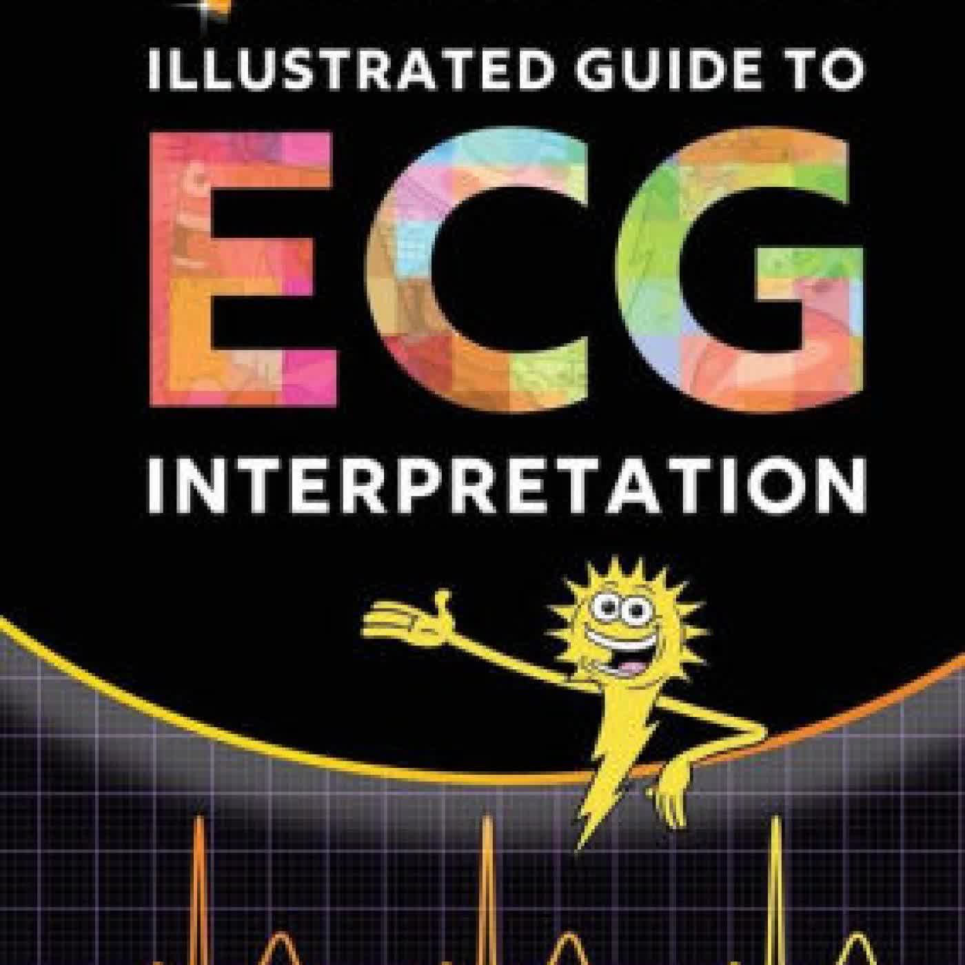 Read online: Sparkson's Illustrated Guide to ECG Interpretation by Jorge Muniz