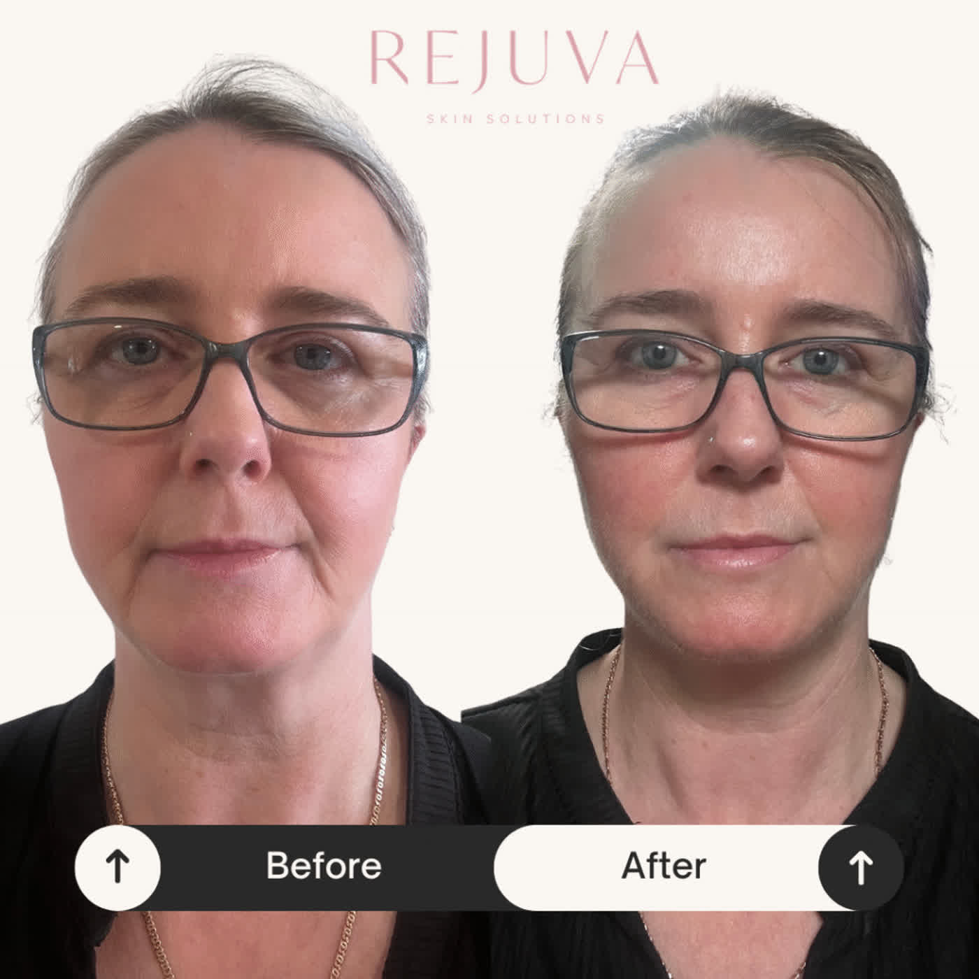 De ultieme Golden Tree Collagen Derma Lift Netherlands recensie (2026)