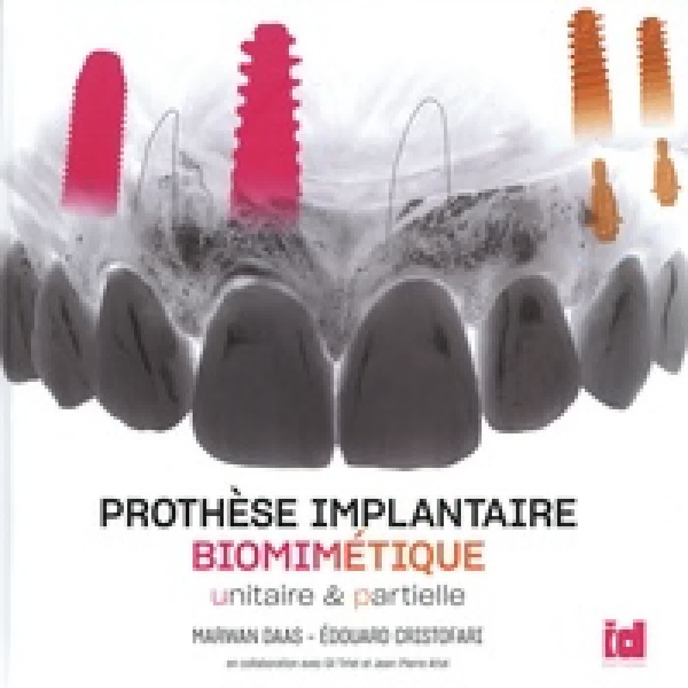 {téléchargement} Prothèse implantaire biomimétique unitaire et partielle