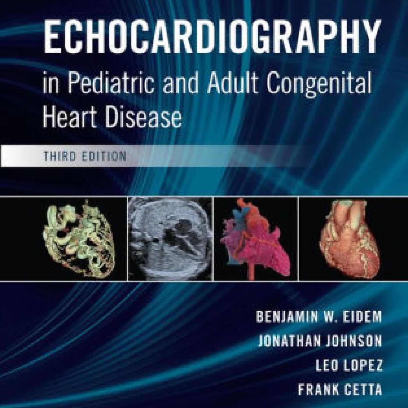 Read online: Echocardiography in Pediatric and Adult Congenital Heart Disease / Edition 3 by Benjamin W. Eidem MD, FACC, FASE, Frank Cetta MD, FACC, FASE, Johnathan Johnson, Leo Lopez