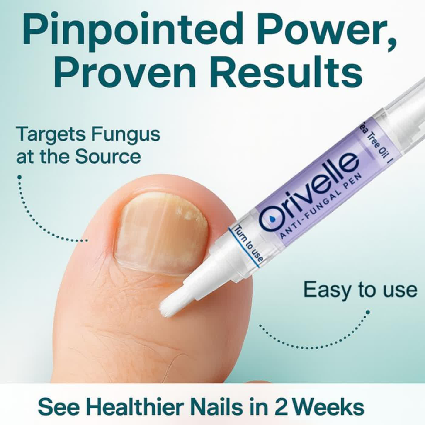Is Orivelle Anti Fungal Pen Worth It? A Critical Review